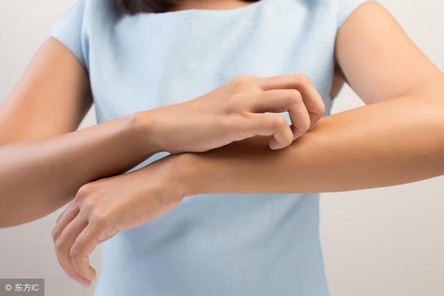 荨麻疹可以吃牛肉吗，慢性荨麻疹不能吃什么（好发荨麻疹的人少吃这3种在食物）