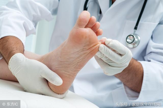 治疗脚气的药膏，脚气用什么药膏（脚气和脚气病有什么不同）