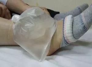 冰块物理降温的方法及注意事项，冰袋物理降温的部位及注意事项（冰敷的正确打开方式）