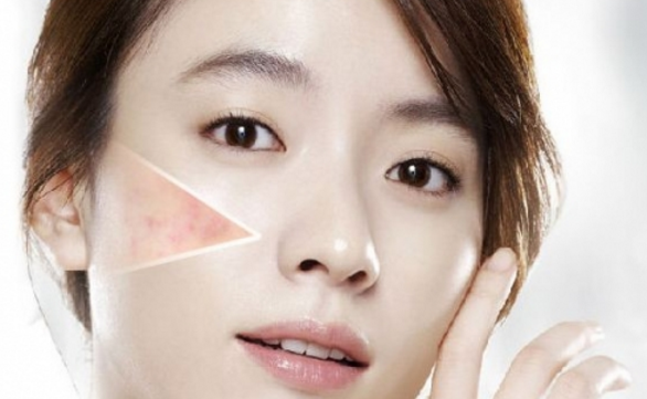 除青春痘小妙招，去除青春痘的10个小窍门（如何让青春痘消失）