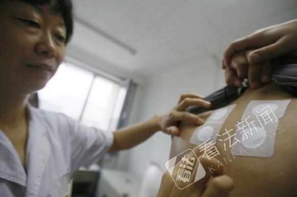 冬病夏治三伏贴价格，2021三伏贴多少钱一个疗程（纳入医保每次收取30元治疗费）
