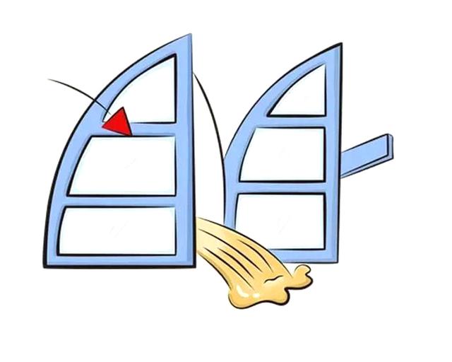 肠痉挛是什么症状，大人肠痉挛是什么症状（肠痉挛，你怎么就不请自来呢）