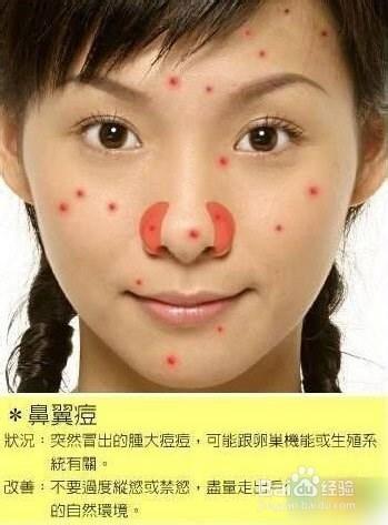 痘痘告诉你哪里生病了，脸上长痘痘怎么调理（长痘痘告诉你 身体哪里生病了）