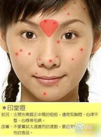 痘痘告诉你哪里生病了，脸上长痘痘怎么调理（长痘痘告诉你 身体哪里生病了）