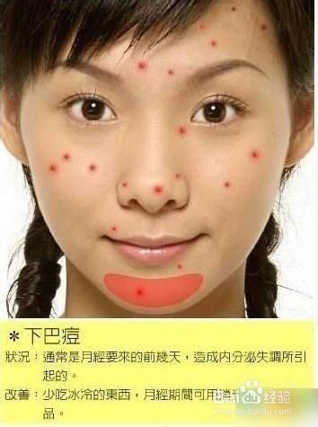 痘痘告诉你哪里生病了，脸上长痘痘怎么调理（长痘痘告诉你 身体哪里生病了）