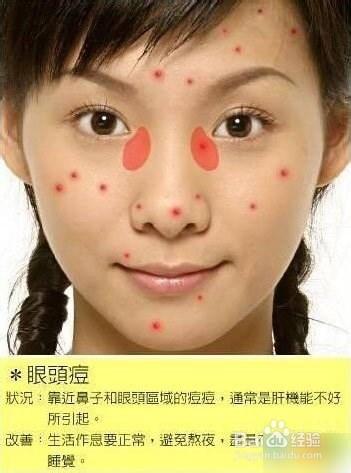 痘痘告诉你哪里生病了，脸上长痘痘怎么调理（长痘痘告诉你 身体哪里生病了）