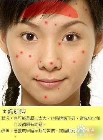 痘痘告诉你哪里生病了，脸上长痘痘怎么调理（长痘痘告诉你 身体哪里生病了）