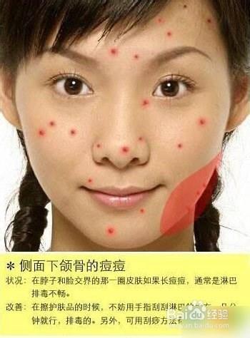 痘痘告诉你哪里生病了，脸上长痘痘怎么调理（长痘痘告诉你 身体哪里生病了）