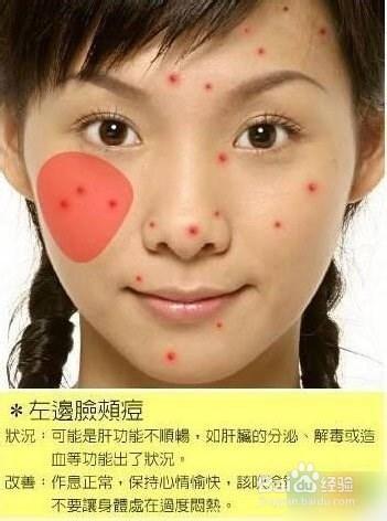 痘痘告诉你哪里生病了，脸上长痘痘怎么调理（长痘痘告诉你 身体哪里生病了）