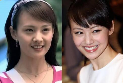 郑爽从对比照来看,脸型和鼻子的确变了很多.