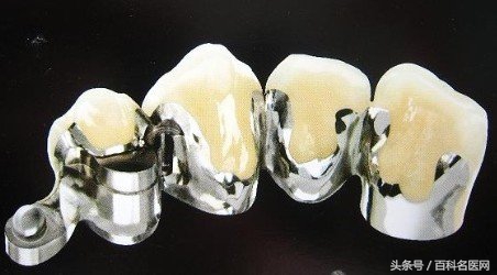 钛合金牙齿价格表整牙真的可以变脸