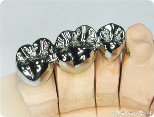 钛合金牙齿价格表整牙真的可以变脸
