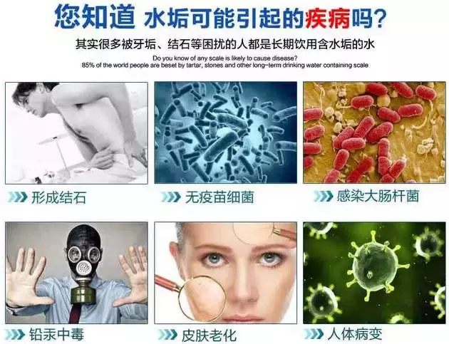 电热水器不清洗，这样的内胆污垢细菌您知道吗？