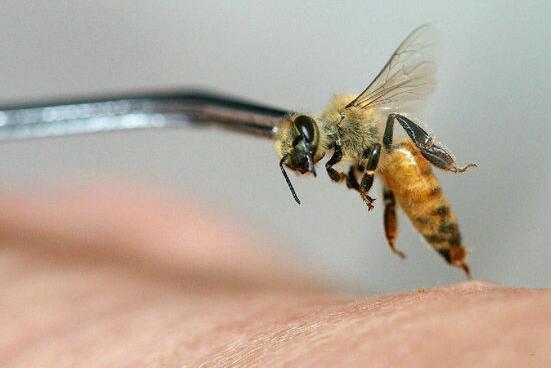 民间治疣子土方法:夹住蜜蜂让螫针刺入疣目皮肤!