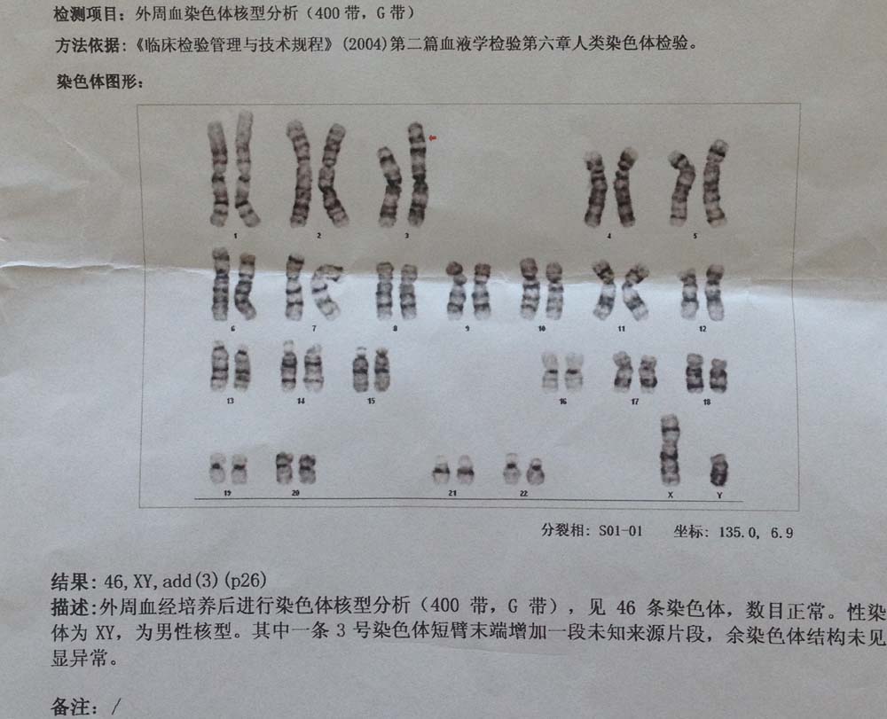 懷孕了做染色體檢查多少錢?