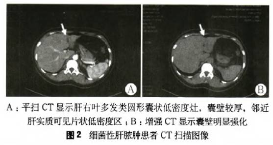 患者反复腹胀，嗜酸性粒细胞升高，提示什么疾病？