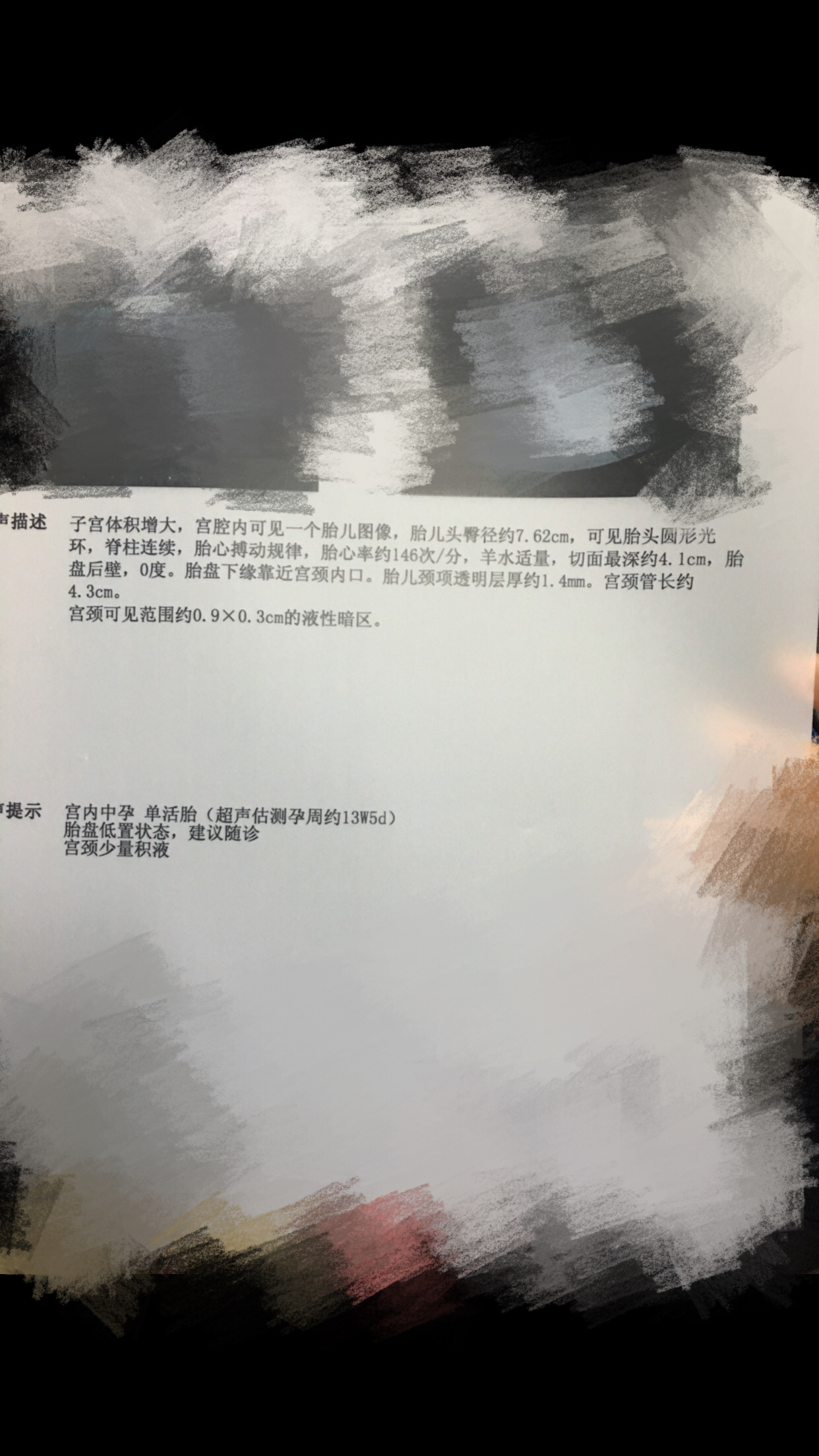 如何辨别你怀的是男孩还是女孩？