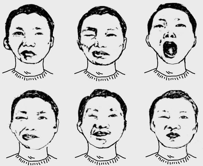 经常性的脸麻嘴麻是怎么回事？