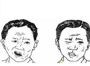 经常性的脸麻嘴麻是怎么回事？