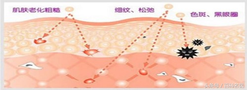 变美秘诀：皮肤科门诊之光子嫩肤，留住年轻、留住美！