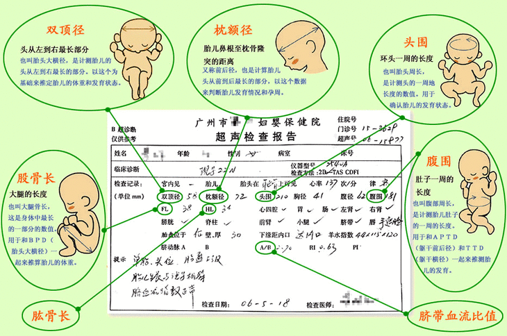 孕期B超要做几次？百分之百准确吗？教你从B超报告单看胎儿健康