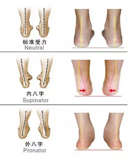 內八字矯正鞋墊 穿矯正鞋墊有副作用 - 時代開運網