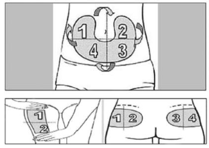 婴儿大腿接种部位图片(胰岛素注射你做对了吗) - 赤虎壹号
