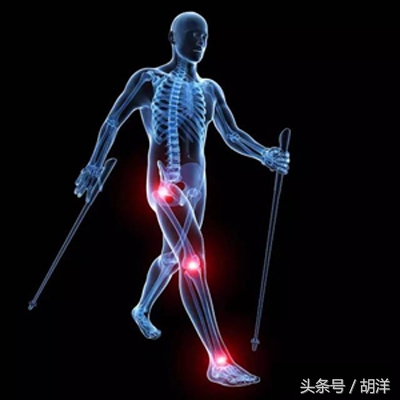 除了肺癌，另一种令呼吸科医生头痛的疾病，间质性肺病的常见原因