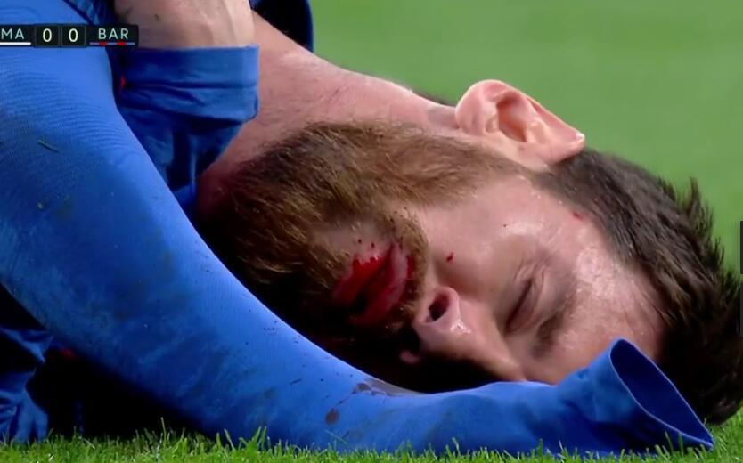 梅西和齐达内踢过球吗(被铁肘打吐血!