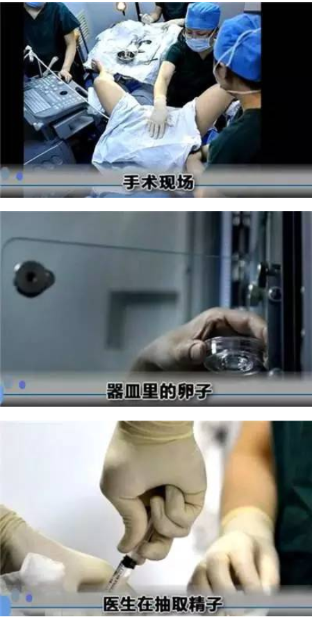 做试管婴儿全过程（附图），男人看完真的心疼女性！