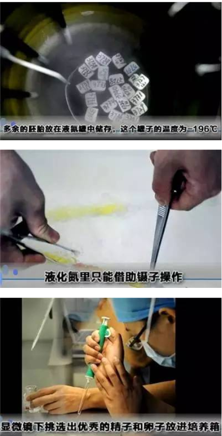 做试管婴儿全过程（附图），男人看完真的心疼女性！