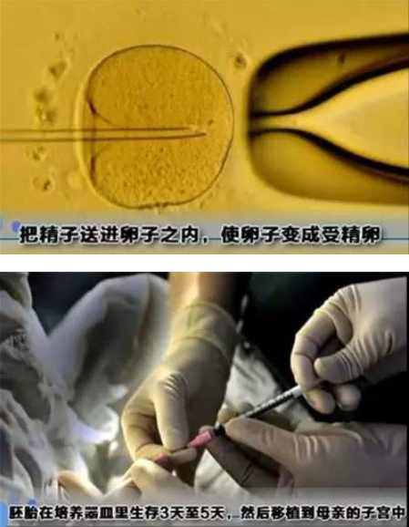做试管婴儿全过程（附图），男人看完真的心疼女性！