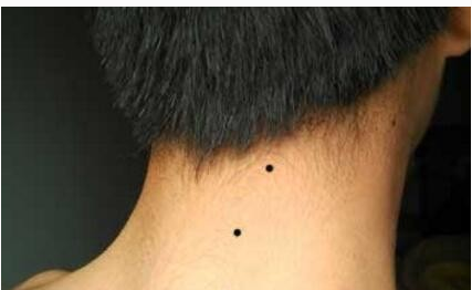 男人脖子左侧边长痣 左侧脖子有痣的男人代表什么好吗_达一风水网