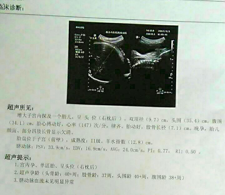 顺产男宝，宝妈们对照一下各种症状和检查单，一样吗？