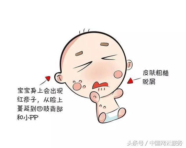 怎么预防婴儿湿疹，大众评医告诉你