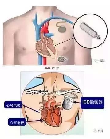 我有假牙，我放了支架，我做了内固定……能做核磁共振检查吗？