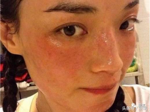 郭碧婷的美空照流出，然而娜扎这高原红脸蛋是怎么回事？