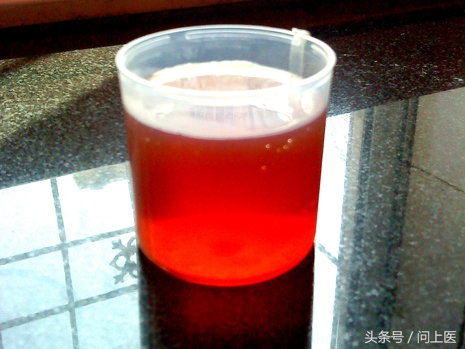 一文教你学会看尿检指标