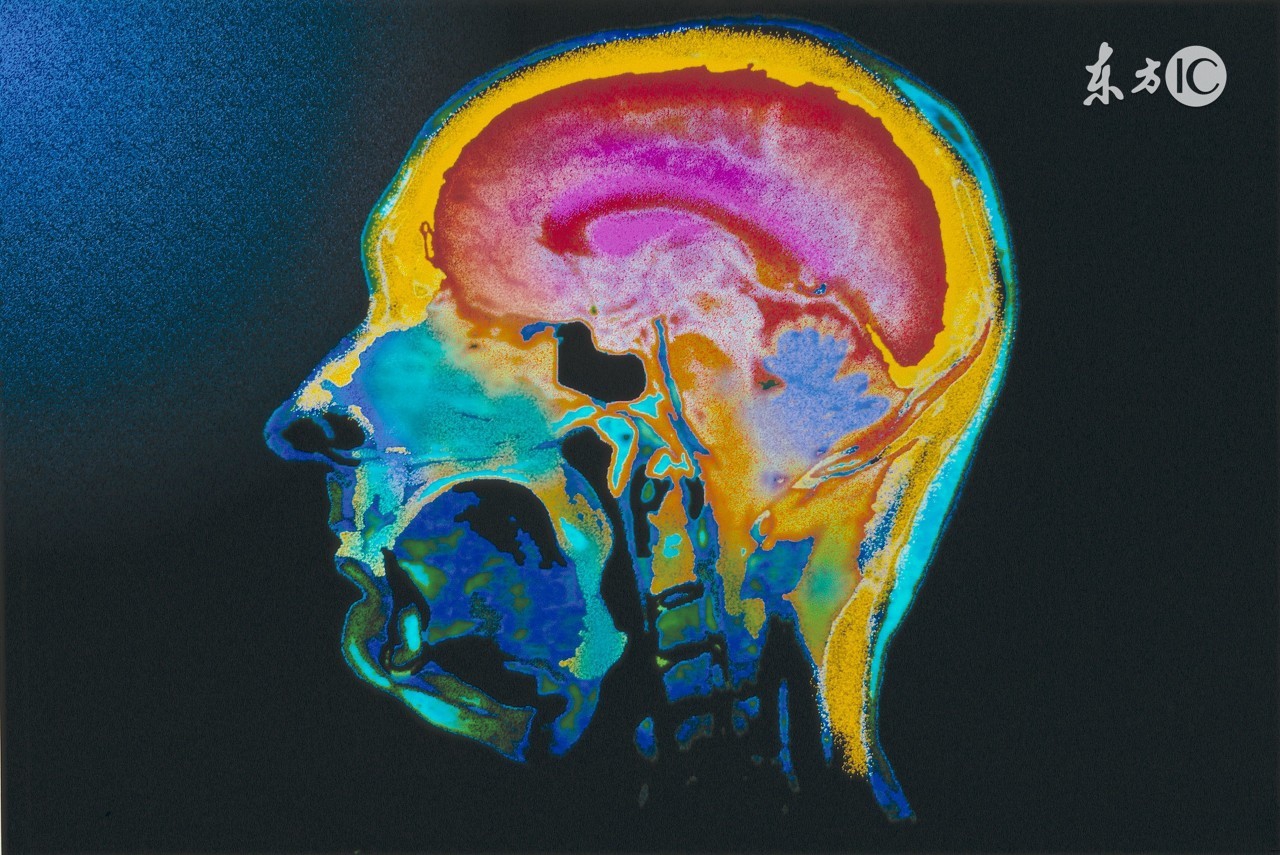 对颅脑损伤的正确认识！