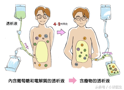 《肾友问，小球答》第六期，你关心的都在这儿，建议收藏！