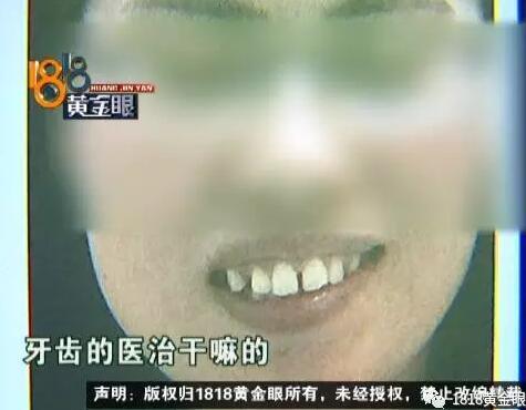 女子花60多万在杭州做牙科美容 做完牙齿不太舒服整个外凸