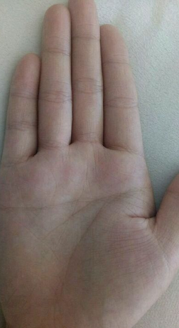 痣相解析男人手掌有痣好不好?财运旺且感情专一!_达一风水网