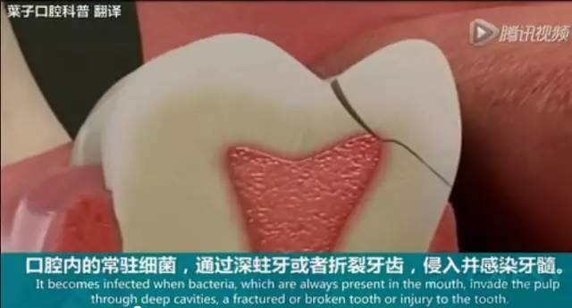 牙龈起脓包，你就只知道吃消炎药？那么脓包下次还会来