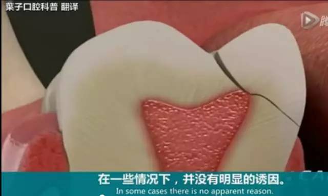 牙龈起脓包，你就只知道吃消炎药？那么脓包下次还会来