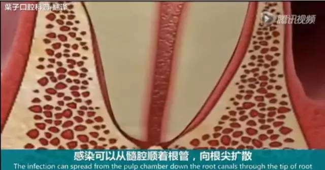 牙龈起脓包，你就只知道吃消炎药？那么脓包下次还会来