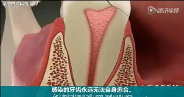牙龈起脓包，你就只知道吃消炎药？那么脓包下次还会来