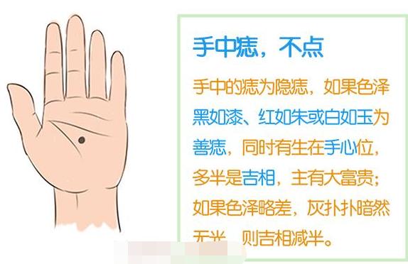 手掌心有痣这种手相的人,男士富贵,做官的会升迁,商的易旺财,女士