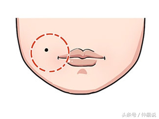 这几个地方长痣，衣食无忧，一生富裕