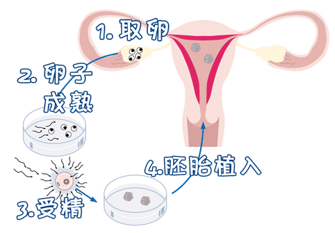 全面揭示试管婴儿的全过程，送给每一位渴望称为母亲的女人