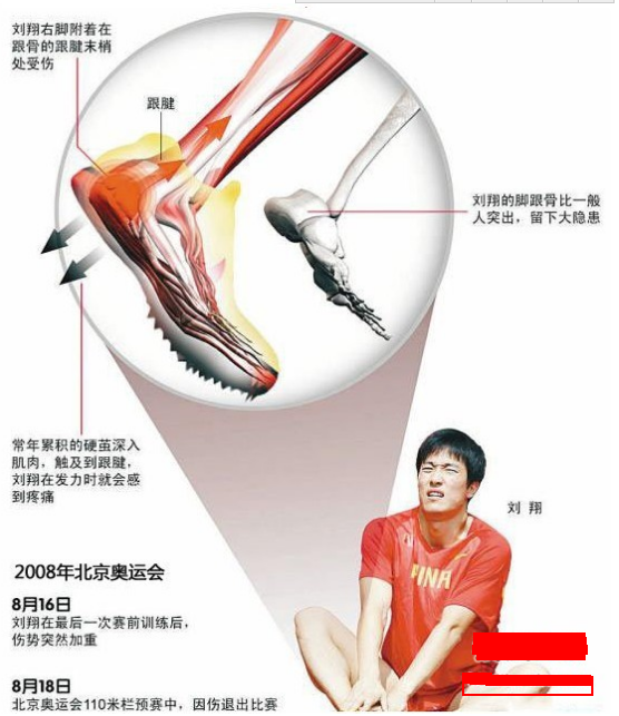 刘翔08年北京因伤退赛到12年伦敦"假摔"的背后发生了什么?